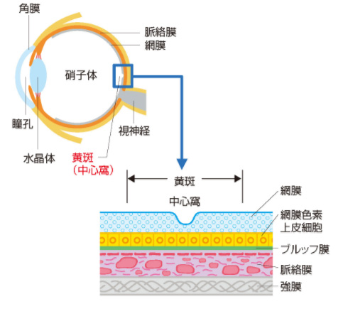 黄斑の状態を説明したイラスト